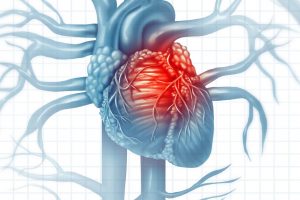 Cardiovascular Diseases and COVID-19