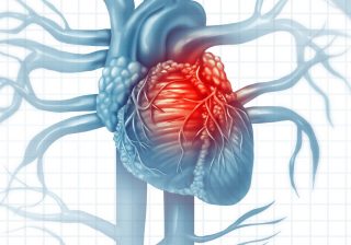 Cardiovascular Diseases and COVID-19