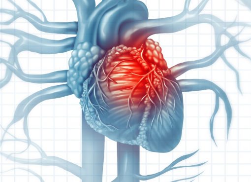 Cardiovascular Diseases and COVID-19