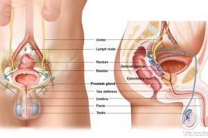 Increasing Risk of Prostate Cancer in India
