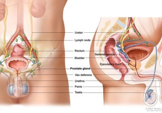 Increasing Risk of Prostate Cancer in India