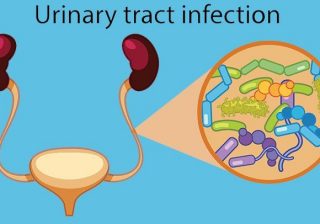 Urinary Tract Infections (UTIs) –  Women are more Vulnerable