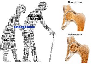Bone Bank – Love your bones