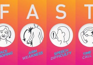 “Time is brain” in stroke – The earlier the treatment, the better the recovery