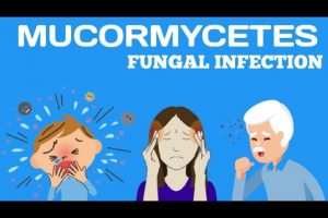 Global Hospitals, Mumbai Parel Launches A Comprehensive Clinic for Treatment of Mucormycosis And Other Invasive Fungal Infections