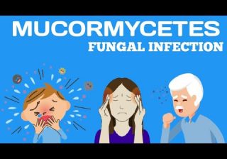 Global Hospitals, Mumbai Parel Launches A Comprehensive Clinic for Treatment of Mucormycosis And Other Invasive Fungal Infections