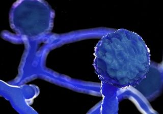 “Black Mould” [Mucormycosis] – the Dark Side of At-home and Self-COVID-19 Treatment