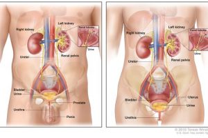 Urinary Tract Infections Spike During Summer: observes Doctor