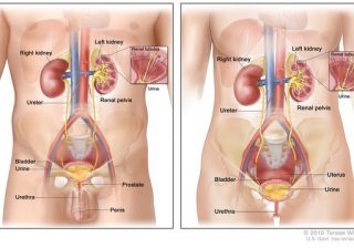 Urinary Tract Infections Spike During Summer: observes Doctor