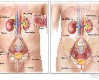 Urinary Tract Infections Spike During Summer: observes Doctor