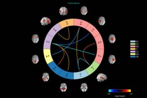 Researchers find Therapeutic Effects of Yoga in Depression