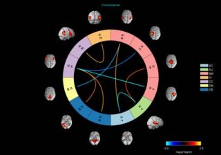 Researchers find Therapeutic Effects of Yoga in Depression