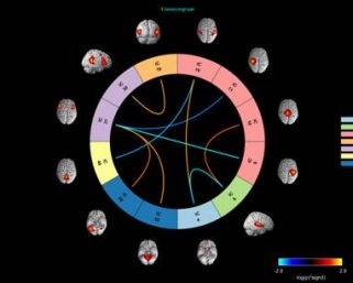 Researchers find Therapeutic Effects of Yoga in Depression