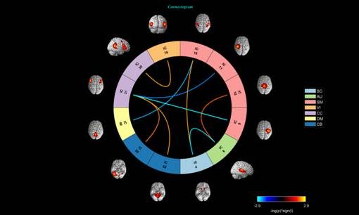 Researchers find Therapeutic Effects of Yoga in Depression