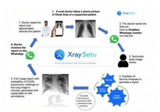 AI-driven ‘XraySetu’ to facilitate early COVID interventions