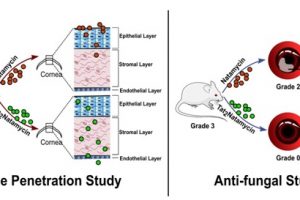Scientists devise new strategy for combating fungal eye infection