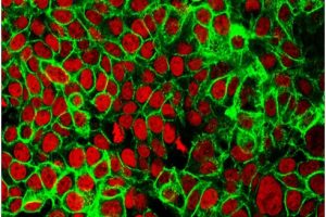 Scientists discover a new way to detect early colon cancer