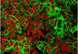 Scientists discover a new way to detect early colon cancer