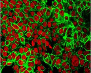 Scientists discover a new way to detect early colon cancer