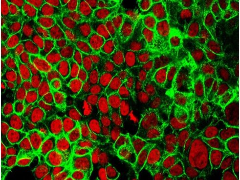 Scientists discover a new way to detect early colon cancer