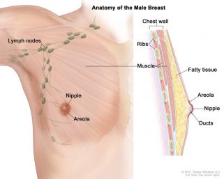 A 70 years old man with stage 1 breast cancer was successfully treated at Wockhardt hospitals Mira Road