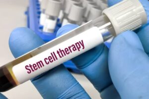 Health Ministry asks states to act against unproven stem cell therapies