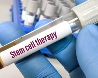 Health Ministry asks states to act against unproven stem cell therapies