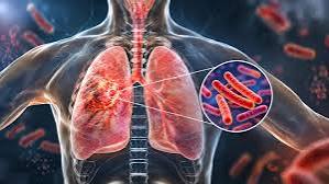 Ministry to launch JOSH Teams to strengthen community participation in TB control